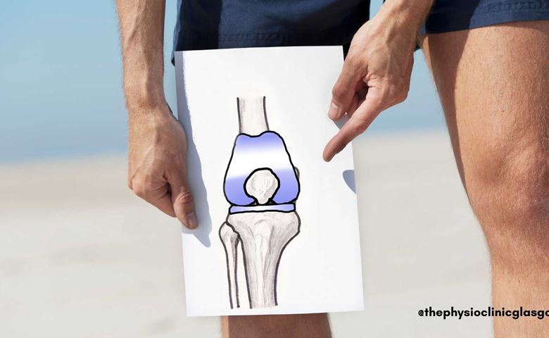 Knee Replacement